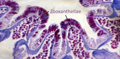 A cross section of a coral polyp showing the zooxanthellae within the tissue. The coral was preserved and processed for viewing under a microscope. The tissue has been stained with a purple dye.