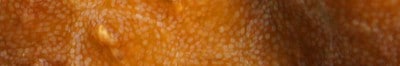 Acoel Flatworms