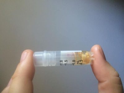 Tubefeet being preserved in ethanol to keep the integrity and DNA of the sample.